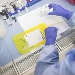 Biyopsi Hakkında Bilinmesi Gerekenler